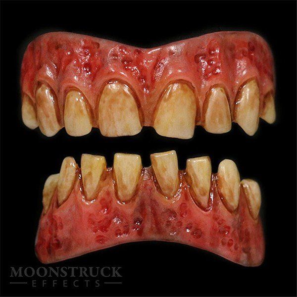 Moonstruck Urit Stained Teeth (dents tachées)